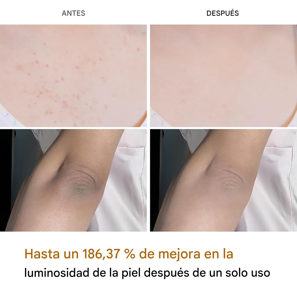 Exfoliante Melaxin - Para Aclarar Partes Oscuras - Fórmula Cúrcuma Beauty